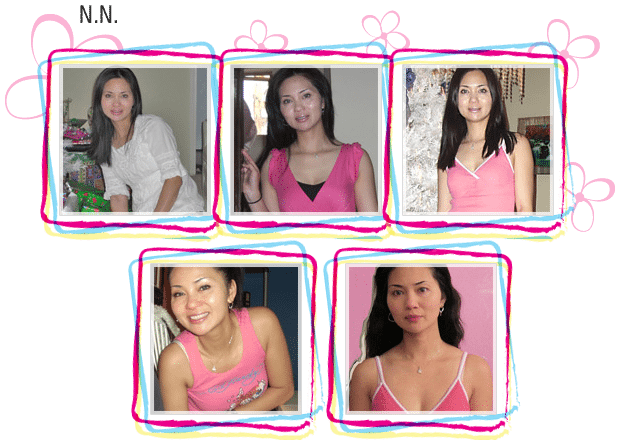 N. N. natural breast enlargement before and after photos
