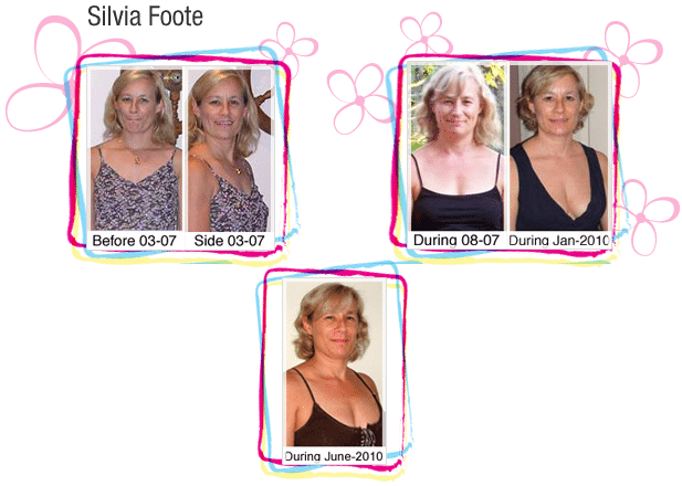 Silvia Foote's before and after breast growth