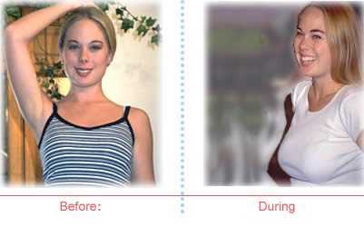 Ally McPherson before and after image