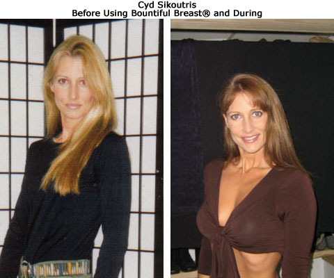 before and after breast growth of Cynthia