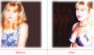 Jennifer Johnson before and after image