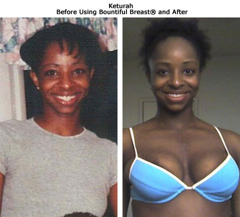 Keturah before and after breast growth