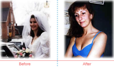 Laura before and after image