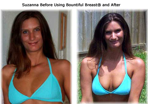 Suzanne before and after breast growth