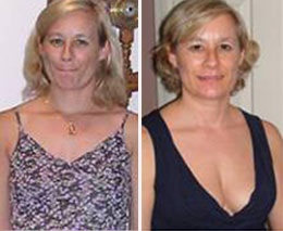 Before and After photo of silvia